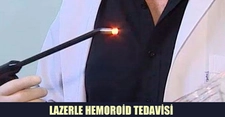 Hemoroid Lazer Tedavisi